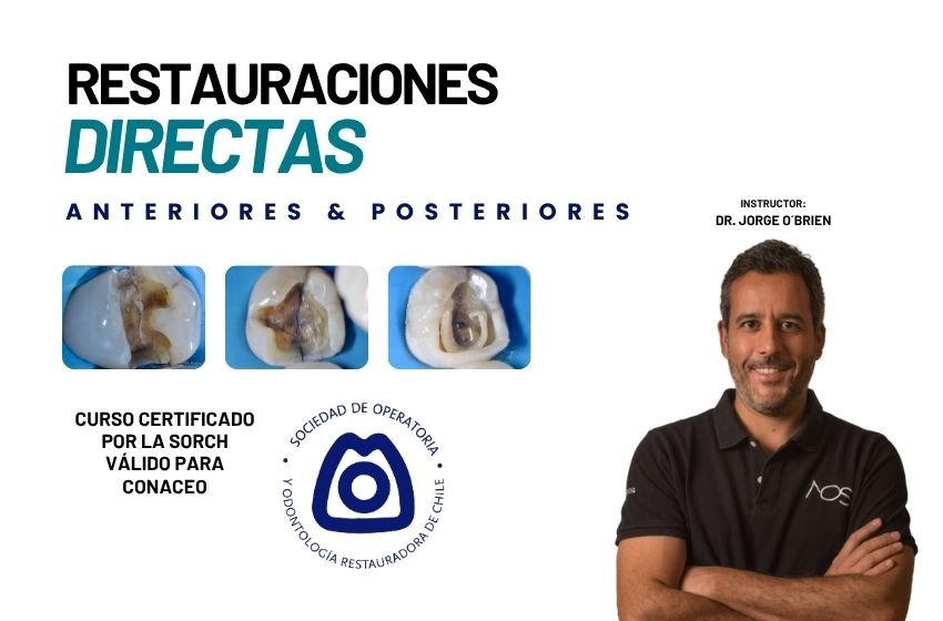 24 y 25 de Abril | Restauraciones directas anteriores y posteriores