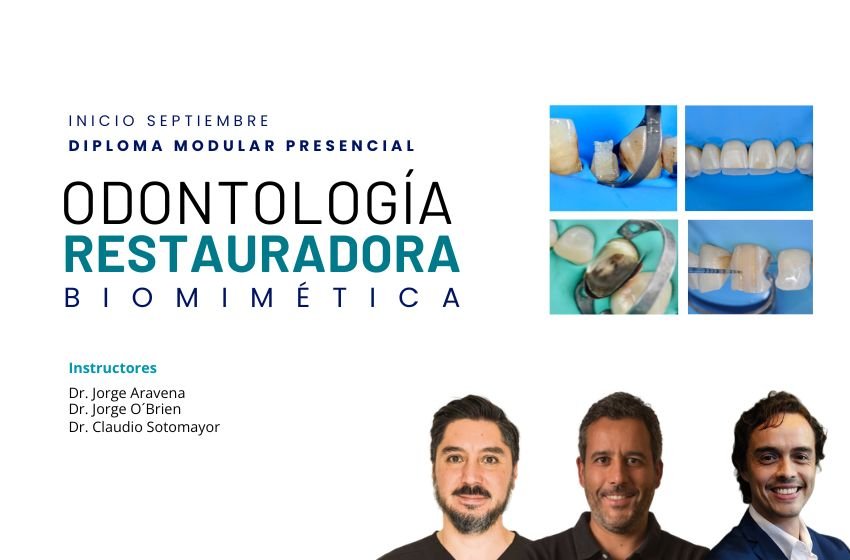 Diploma modular teórico-práctico-clínico en Odontología Restauradora Adhesiva estructural y Biomimética. Segunda Versión